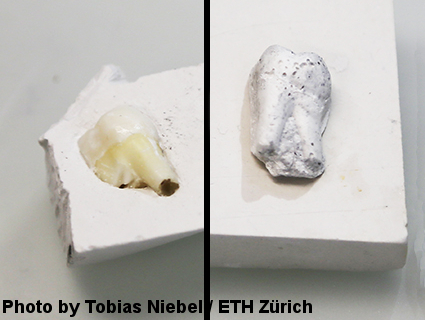 Ein natürlicher Zahn, daneben das Imitat aus neuem Verbundmaterial