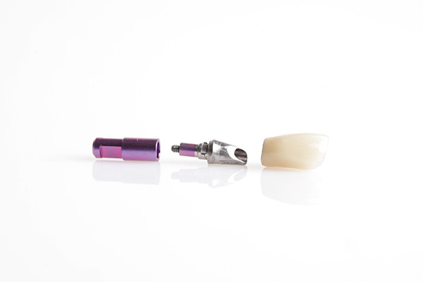 Komponenten für implantatgetragenen Zahnersatz