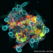 Streptokokken und Candida albicans besiedeln gemeinschaftlich glatte Oberflächen im Mundraum Mikroskopische Aufnahme einer Zellgemeinschaft aus Streptococcus mutans (grün) und dem Hefepilz Candida albicans (blau)