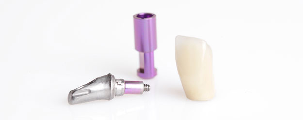 Abbildung eines Implantats von dentaltrade ProLine